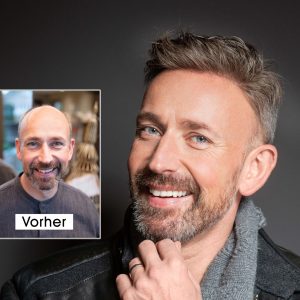 contactskin-peter-vorher-nachher